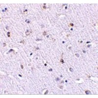 NANOS1 / NOS1 Antibody - Immunohistochemistry of Nanos1 in human brain tissue with Nanos1 antibody at 2.5 µg/mL