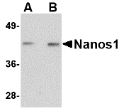 NANOS1 / NOS1 Antibody - Western blot of Nanos1 in rat brain tissue lysate with Nanos1 antibody at (A) 1 and (B) 2 ug/ml.