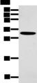NANOS1 / NOS1 Antibody - Western blot analysis of Mouse muscle tissue  using NANOS1 Polyclonal Antibody at dilution of 1:400