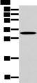 NANOS1 / NOS1 Antibody - Western blot analysis of Mouse muscle tissue  using NANOS1 Polyclonal Antibody at dilution of 1:500