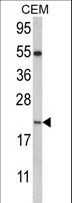 NANOS2 / NOS2 Antibody - Western blot of NANOS2 Antibody in CEM cell line lysates (35 ug/lane). NANOS2 (arrow) was detected using the purified antibody.
