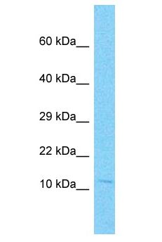 NANOS2 / NOS2 Antibody - NANOS2 / NOS2 antibody Western Blot of Jurkat. Antibody dilution: 1 ug/ml.  This image was taken for the unconjugated form of this product. Other forms have not been tested.