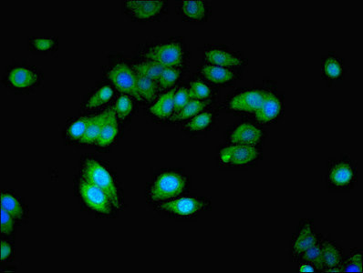 NANOS2 / NOS2 Antibody - Immunofluorescent analysis of HepG2 cells using NANOS2 Antibody at dilution of 1:100 and Alexa Fluor 488-congugated AffiniPure Goat Anti-Rabbit IgG(H+L)