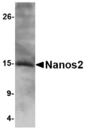 NANOS2 / NOS2 Antibody - Western blot of Nanos2 in SK-N-SH cell lysate with Nanos2 antibody at 2 ug/ml.