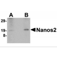 NANOS2 / NOS2 Antibody - Western blot analysis of Nanos2 in human testis lyate with Nanos2 antibody at (A) 2 and (B) 4 µg/mL.
