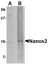 NANOS2 / NOS2 Antibody - Western blot of Nanos2 in rat brain tissue lysate with Nanos2 antibody at (A) 1 and (B) 2 ug/ml.