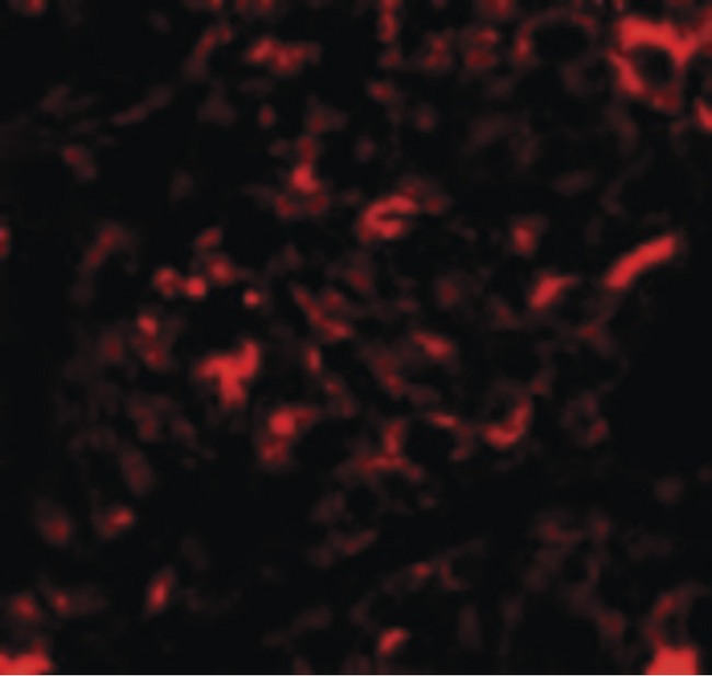 NANOS2 / NOS2 Antibody - Immunofluorescence of Nanos2 in Human Testis cells with Nanos2 antibody at 20 ug/ml.