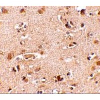NANOS2 / NOS2 Antibody - Immunohistochemistry of Nanos2 in human brain tissue cells with Nanos2 antibody at 2.5 µg/mL.