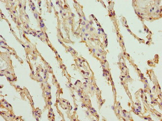 NANOS3 / NOS-3 Antibody - Immunohistochemistry of paraffin-embedded human lung tissue using PROCR Antibody at dilution of 1:100