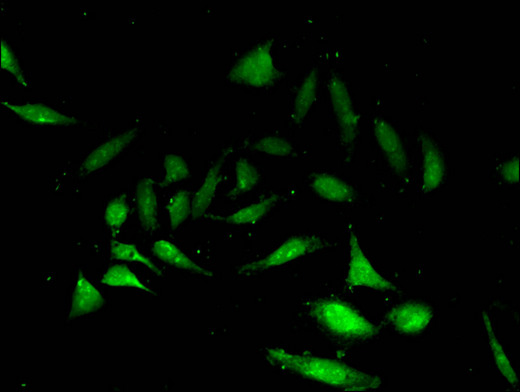 NANOS3 / NOS-3 Antibody - Immunofluorescent analysis of Hela cells using NANOS3 Antibody at a dilution of 1:100 and Alexa Fluor 488-congugated AffiniPure Goat Anti-Rabbit IgG(H+L)