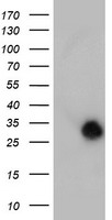 NANP Antibody - HEK293T cells were transfected with the pCMV6-ENTRY control (Left lane) or pCMV6-ENTRY NANP (Right lane) cDNA for 48 hrs and lysed. Equivalent amounts of cell lysates (5 ug per lane) were separated by SDS-PAGE and immunoblotted with anti-NANP.
