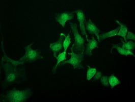 NANP Antibody - Immunofluorescent staining of HeLa cells using anti-NANP mouse monoclonal antibody.