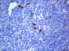NANP Antibody - IHC of paraffin-embedded Human lymph node tissue using anti-NANP mouse monoclonal antibody. (Heat-induced epitope retrieval by 10mM citric buffer, pH6.0, 120°C for 3min).