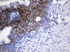 NANP Antibody - IHC of paraffin-embedded Human prostate tissue using anti-NANP mouse monoclonal antibody.