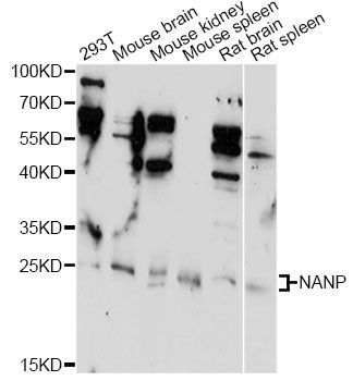 NANP Antibody - Western blot analysis of extracts of various cell lines, using NANP antibody at 1:1000 dilution. The secondary antibody used was an HRP Goat Anti-Rabbit IgG (H+L) at 1:10000 dilution. Lysates were loaded 25ug per lane and 3% nonfat dry milk in TBST was used for blocking. An ECL Kit was used for detection and the exposure time was 90s.