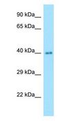 NANS Antibody - NANS antibody Western Blot of Human Lung.  This image was taken for the unconjugated form of this product. Other forms have not been tested.