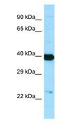 NANS Antibody - NANS antibody Western Blot of Human brain.  This image was taken for the unconjugated form of this product. Other forms have not been tested.