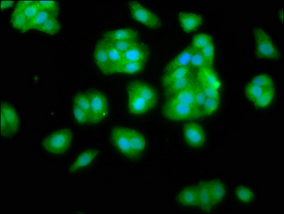 NANS Antibody - Immunofluorescence staining of HepG2 cells at a dilution of 1:66, counter-stained with DAPI. The cells were fixed in 4% formaldehyde, permeabilized using 0.2% Triton X-100 and blocked in 10% normal Goat Serum. The cells were then incubated with the antibody overnight at 4 °C.The secondary antibody was Alexa Fluor 488-congugated AffiniPure Goat Anti-Rabbit IgG (H+L) .