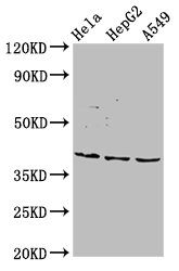 NANS Antibody - Positive Western Blot detected in Hela whole cell lysate, HepG2 whole cell lysate, A549 whole cell lysate. All lanes: NANS antibody at 5.5 µg/ml Secondary Goat polyclonal to rabbit IgG at 1/50000 dilution. Predicted band size: 41 KDa. Observed band size: 41 KDa
