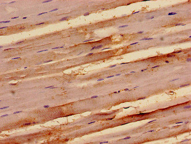 NAP1 / TAB3 Antibody - Immunohistochemistry analysis of human skeletal muscle tissue at a dilution of 1:100