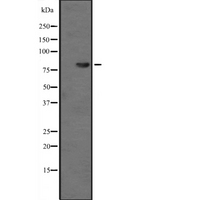 NAP1 / TAB3 Antibody - Western blot analysis of TAB3 expression in HeLa cells lysate. The lane on the left is treated with the antigen-specific peptide.