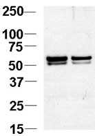 NAP1L1 Antibody - Western blot of NAP1L1 Antibody in Jurkat cell lysates. NAP1L1 was detected using the purified antibody at 1:1000. Data courtesy of Guoqiang Xu, Cornell University.