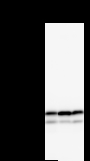 NAP1L1 Antibody - Detection of NAP1L1 by Western blot. Samples: Whole cell lysate from human HT-1080 (H, 25 ug) , mouse NIH3T3 (M, 25 ug) and rat F2408 (R, 25 ug) cells. Predicted molecular weight: 45 kDa