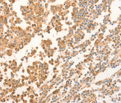 NAP1L1 Antibody - Immunohistochemistry of paraffin-embedded human tonsil tissue.