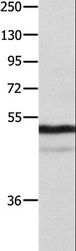 NAP1L1 Antibody - Western blot analysis of Mouse thymus tissue, using NAP1L1 Polyclonal Antibody at dilution of 1:1000.