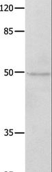NAP1L1 Antibody - Western blot analysis of Jurkat cell, using NAP1L1 Polyclonal Antibody at dilution of 1:650.