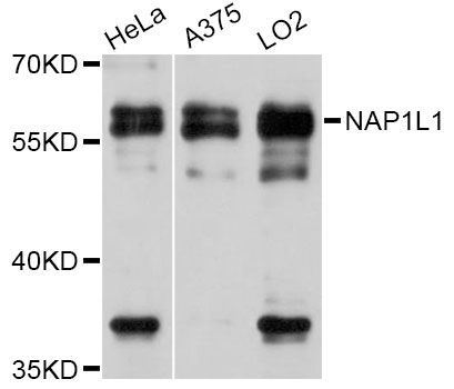 NAP1L1 Antibody - Western blot analysis of extracts of various cell lines, using NAP1L1 Antibody at 1:3000 dilution. The secondary antibody used was an HRP Goat Anti-Rabbit IgG (H+L) at 1:10000 dilution. Lysates were loaded 25ug per lane and 3% nonfat dry milk in TBST was used for blocking. An ECL Kit was used for detection and the exposure time was 20s.