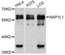 NAP1L1 Antibody - Western blot analysis of extracts of various cell lines, using NAP1L1 Antibody at 1:3000 dilution. The secondary antibody used was an HRP Goat Anti-Rabbit IgG (H+L) at 1:10000 dilution. Lysates were loaded 25ug per lane and 3% nonfat dry milk in TBST was used for blocking. An ECL Kit was used for detection and the exposure time was 20s.