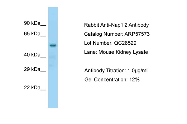 NAP1L2 / BPX Antibody -  This image was taken for the unconjugated form of this product. Other forms have not been tested.