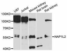 NAP1L2 / BPX Antibody - Western blot analysis of extracts of various cell lines, using NAP1L2 antibody at 1:3000 dilution. The secondary antibody used was an HRP Goat Anti-Rabbit IgG (H+L) at 1:10000 dilution. Lysates were loaded 25ug per lane and 3% nonfat dry milk in TBST was used for blocking. An ECL Kit was used for detection and the exposure time was 90s.