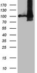 NAP1L3 Antibody - HEK293T cells were transfected with the pCMV6-ENTRY control. (Left lane) or pCMV6-ENTRY NAP1L3. (Right lane) cDNA for 48 hrs and lysed