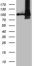 NAP1L3 Antibody - HEK293T cells were transfected with the pCMV6-ENTRY control. (Left lane) or pCMV6-ENTRY NAP1L3. (Right lane) cDNA for 48 hrs and lysed