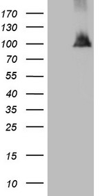 NAP1L3 Antibody - HEK293T cells were transfected with the pCMV6-ENTRY control. (Left lane) or pCMV6-ENTRY NAP1L3. (Right lane) cDNA for 48 hrs and lysed. Equivalent amounts of cell lysates. (5 ug per lane) were separated by SDS-PAGE and immunoblotted with anti-NAP1L3. (1:2000)
