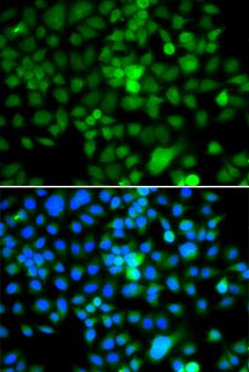 NAP1L3 Antibody - Immunofluorescence analysis of A549 cells using NAP1L3 Polyclonal Antibody.