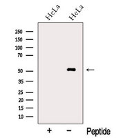NAP1L4 Antibody - Western blot analysis of extracts of HeLa cells using NAP1L4 antibody. The lane on the left was treated with blocking peptide.