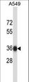 NAPB / SNAPB Antibody - NAPB Antibody western blot of A549 cell line lysates (35 ug/lane). The NAPB antibody detected the NAPB protein (arrow).