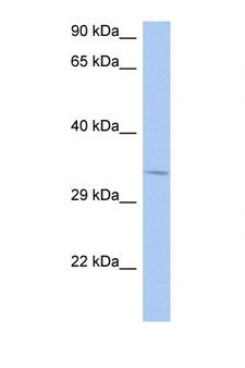 NAPB / SNAPB Antibody - NAPB antibody Western blot of SYSY Cell lysate. Antibody concentration 1 ug/ml. This image was taken for the unconjugated form of this product. Other forms have not been tested.