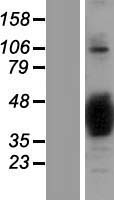 NAPB / SNAPB Protein - Western validation with an anti-DDK antibody * L: Control HEK293 lysate R: Over-expression lysate