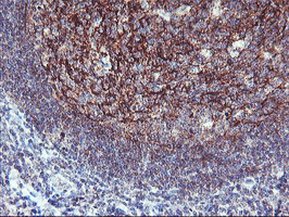 NAPE-PLD Antibody - Immunohistochemical staining of paraffin-embedded Human tonsil within the normal limits using anti-NAPEPLD mouse monoclonal antibody. (Heat-induced epitope retrieval by 10mM citric buffer, pH6.0, 100C for 10min,