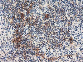 NAPE-PLD Antibody - IHC of paraffin-embedded Human lymphoma tissue using anti-NAPEPLD mouse monoclonal antibody.