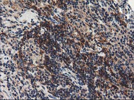 NAPE-PLD Antibody - IHC of paraffin-embedded Human lymphoma tissue using anti-NAPEPLD mouse monoclonal antibody.