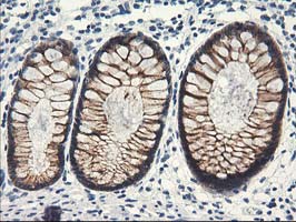 NAPE-PLD Antibody - IHC of paraffin-embedded Human colon tissue using anti-NAPEPLD mouse monoclonal antibody.