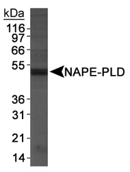 NAPE-PLD Antibody - NAPE-PLD Antibody Detection of NAPE-PLD antibody in DU145 cell extracts.