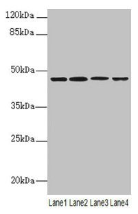 NAPE-PLD Antibody - Western blot All lanes: NAPEPLD antibody at 6µg/ml Lane 1: Mouse large intestine tissue Lane 2: Mouse kidney tissue Lane 3: Mouse stomach tissue Lane 4: MCF-7 whole cell lysate Secondary Goat polyclonal to rabbit IgG at 1/10000 dilution Predicted band size: 46 kDa Observed band size: 46 kDa
