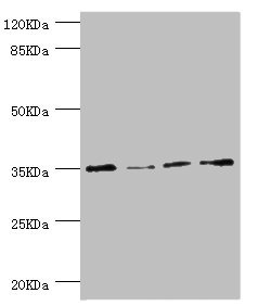 NAPG Antibody - Western blot All Lanes:NAPG antibody at 1.1ug/ml Lane 1:HepG2 whole cell lysate Lane 2:Hela whole cell lysate Lane 3:U251 whole cell lysate Lane 4:K562 whole cell lysate Secondary Goat polyclonal to rabbit at 1/10000 dilution Predicted band size: 35,26 kDa Observed band size: 35 kDa