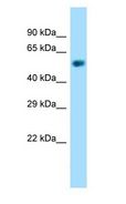 NAPRT Antibody - NAPRT1 antibody Western Blot of Mouse Kidney.  This image was taken for the unconjugated form of this product. Other forms have not been tested.